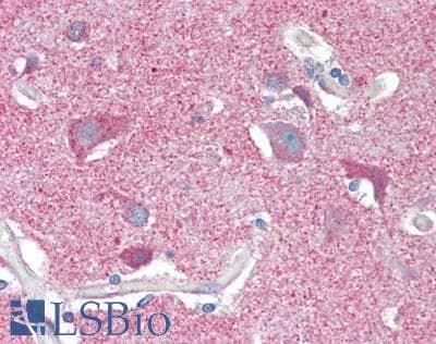 IHC-plus™ Polyclonal Rabbit anti-Human CLTC / Clathrin Heavy Chain Antibody (IHC, WB)