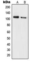 Polyclonal Rabbit anti-Human RB1 / Retinoblastoma / RB Antibody (phospho-Ser780, IHC, IF, WB)