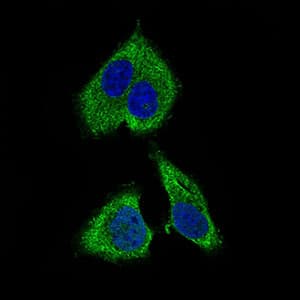 Monoclonal Mouse anti-Human RPL18A Antibody (clone 6G6G10, aa50-176, IHC, IF, WB)