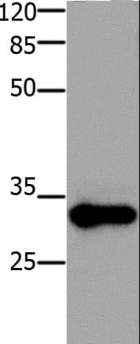 ADO Antibody