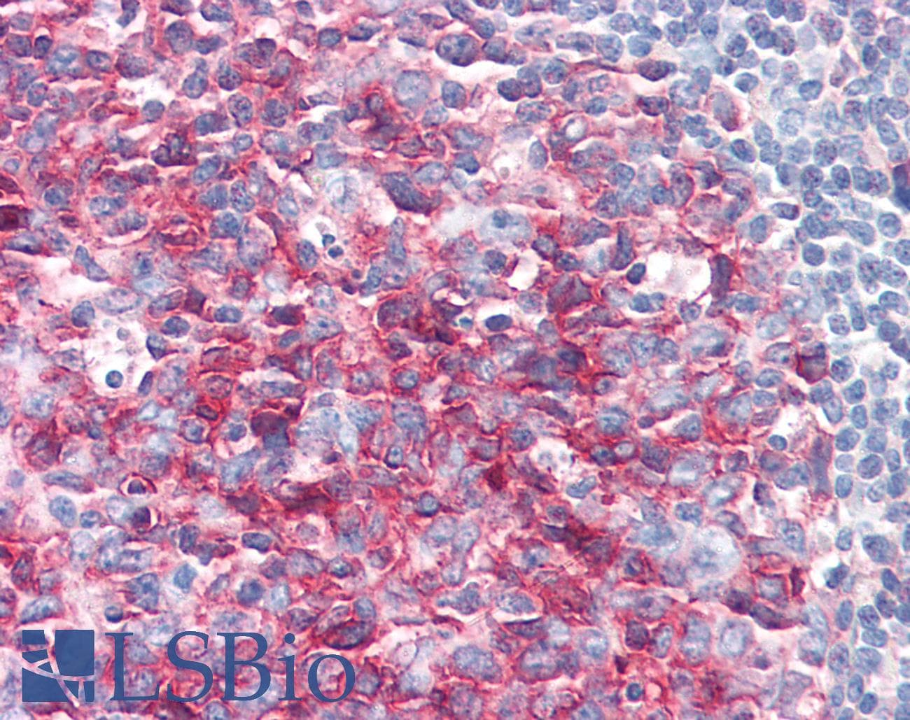 IHC-plus™ Polyclonal Rabbit anti-Human PAG1 Antibody (clone Polyclonal, aa97-432, IHC, WB)