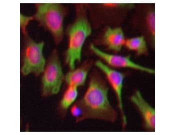 PABPC1 / PABP1 Antibody (clone 10E10)