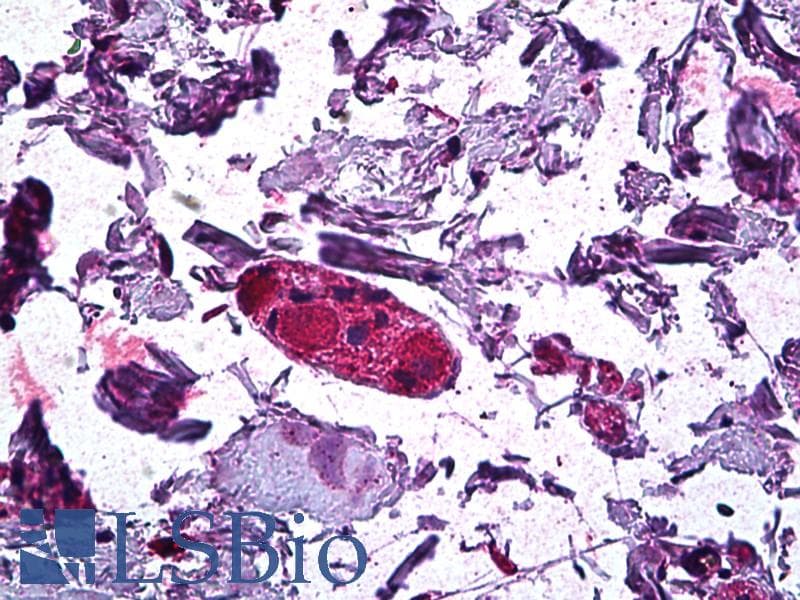IHC-plus™ Polyclonal Goat anti-Human DGAT1 Antibody (aa217-229, IHC, WB)