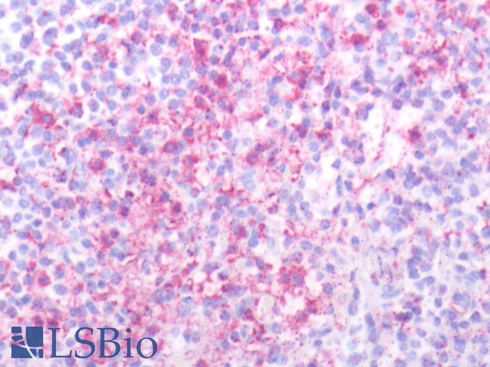 IHC-plus™ SSTR2 Antibody (Extracellular Domain)