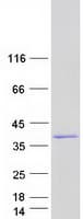 Human UP / UPP1 Protein (Recombinant Myc-DDK (Flag))