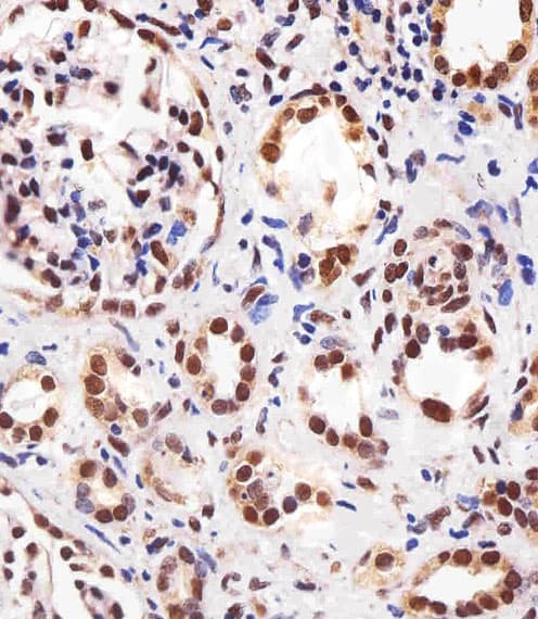 Monoclonal Mouse anti-Human PPARA / PPAR Alpha Antibody (clone 1331CT894.186.143, IHC, IF, WB)