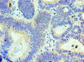 ALKBH8 Antibody (aa1-230)
