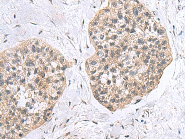 RPL18 / Ribosomal Protein L18 Antibody