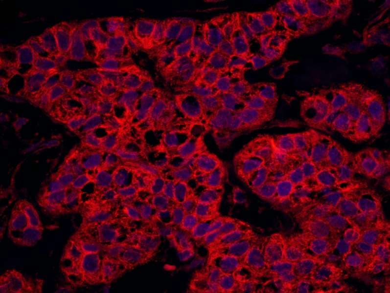 Polyclonal Rabbit anti-Human SEPT9 / Septin 9 Antibody (aa536-586)