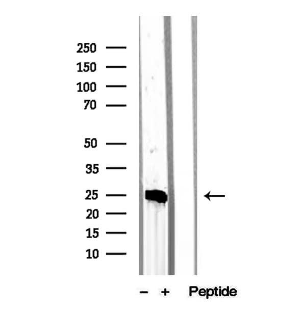 MPZL2 Antibody