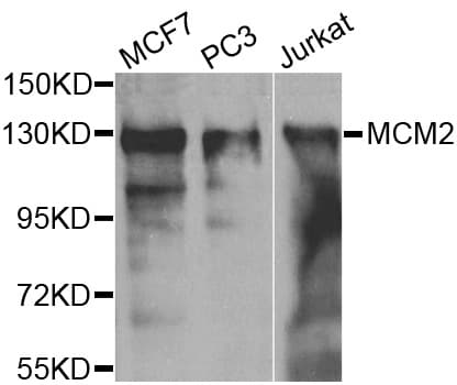 MCM2 Antibody