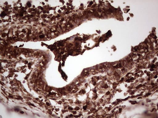 LGALS9 / Galectin 9 Antibody (clone OTI1D12)