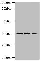 FOSL2 / FRA-2 Antibody (aa187-326)