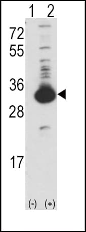 KHK / Ketohexokinase Antibody (aa18-46)