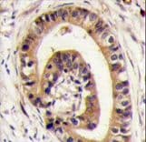 GOPC / PIST Antibody (aa361-390)
