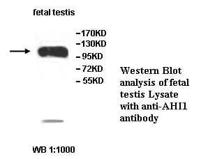 Polyclonal Rabbit anti-Human AHI1 Antibody (IHC, WB)