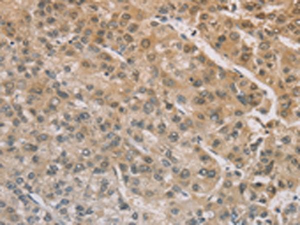 Polyclonal Rabbit anti-Human ZIC2 Antibody (IHC)