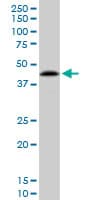 PPP1R8 / Rnase E Antibody (clone 1G11)