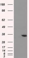 AKR1A1 Antibody (clone OTI6E3)