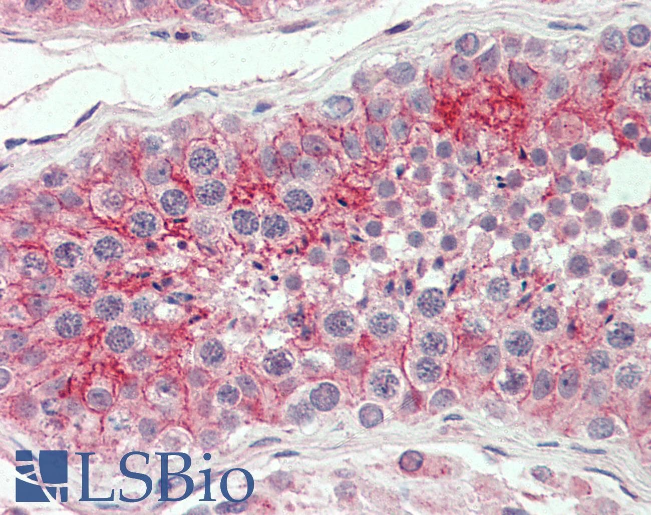 IHC-plus™ CXADR Antibody (Internal)