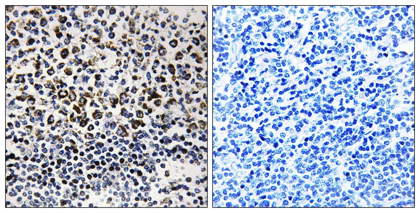 Polyclonal Rabbit anti-Human GC1qR / C1QBP Antibody (IHC, WB)