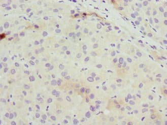 Osteocalcin Antibody