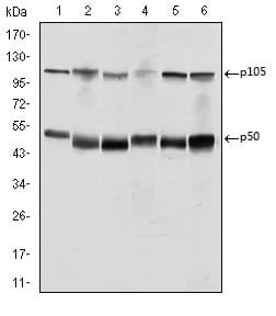 NFKB1 / NF-Kappa-B Antibody (clone 5D10D11)