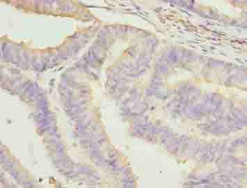 NRARP Antibody