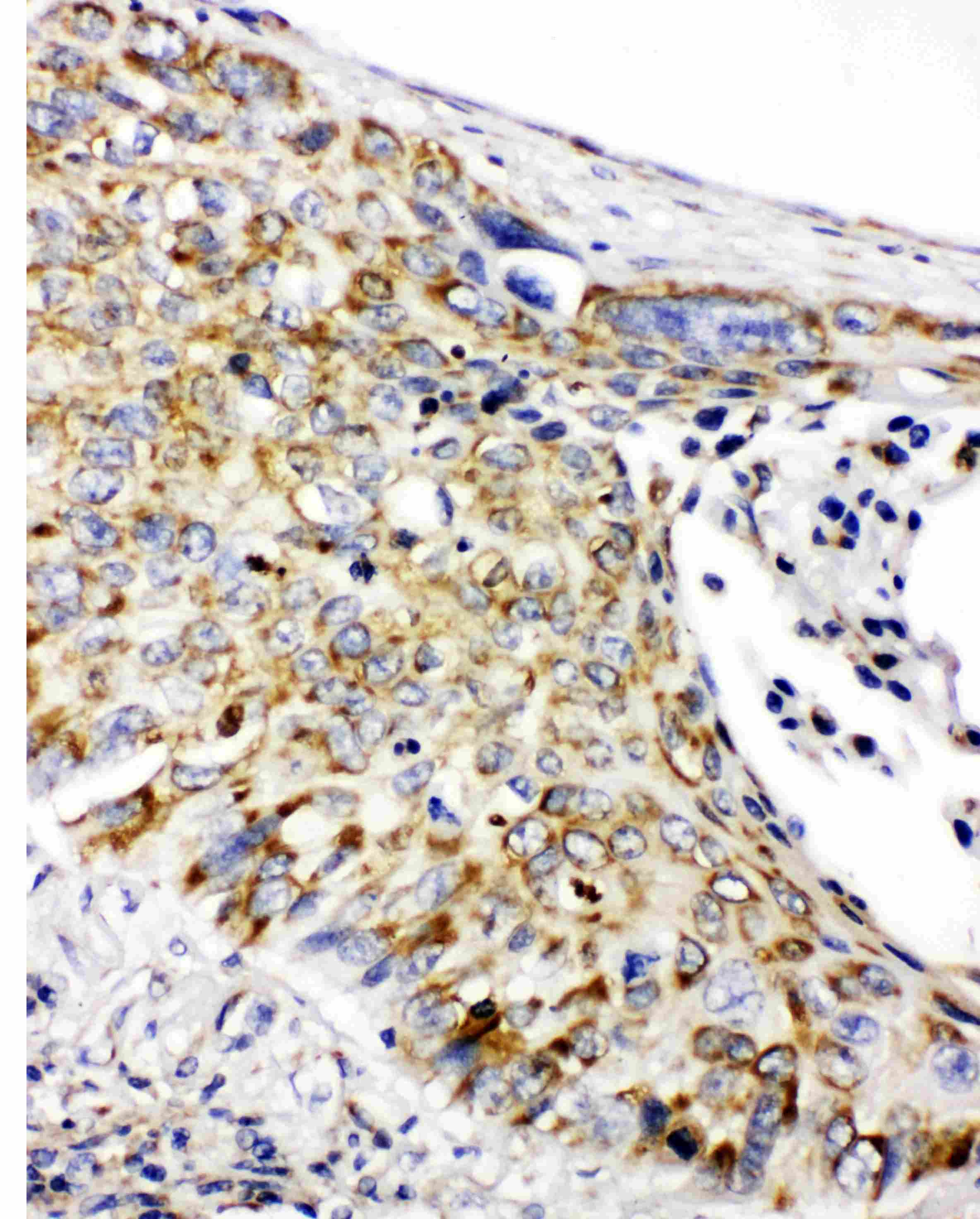 Polyclonal Rabbit anti-Human PHB / Prohibitin Antibody (aa240-256, IHC, WB)