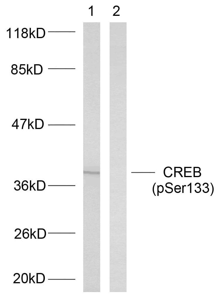Polyclonal Rabbit anti-Human CREB1 / CREB Antibody (phospho-Ser133, IHC, WB)