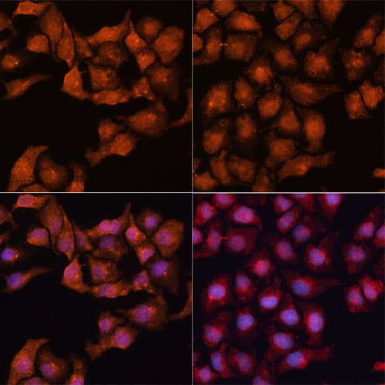Polyclonal Rabbit anti-Human MAP1LC3B / LC3B Antibody (IHC, IF, WB)