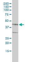 BGN / Biglycan Antibody (clone 4E1-1G7)