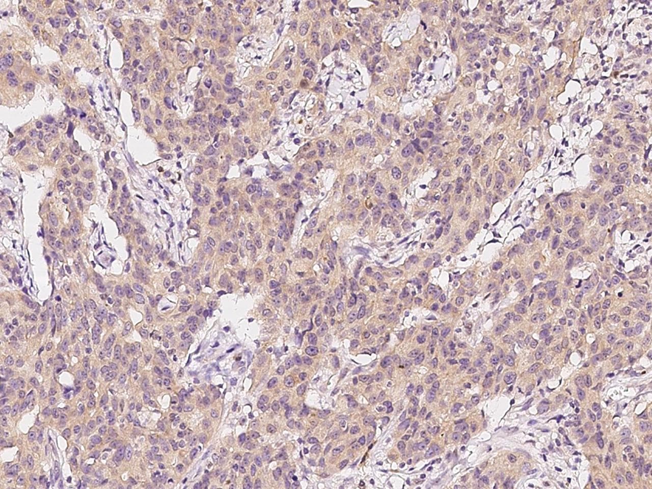 NMT2 Antibody
