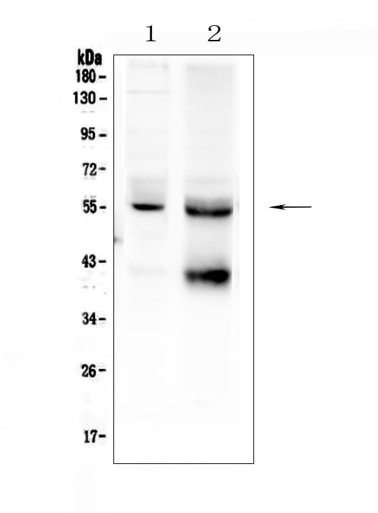TGFBR1 / ALK5 Antibody (aa149-186)