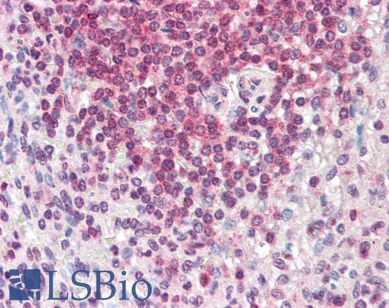 IHC-plus™ Polyclonal Goat anti-Human ARHGAP45 Antibody (aa57-71, IHC)