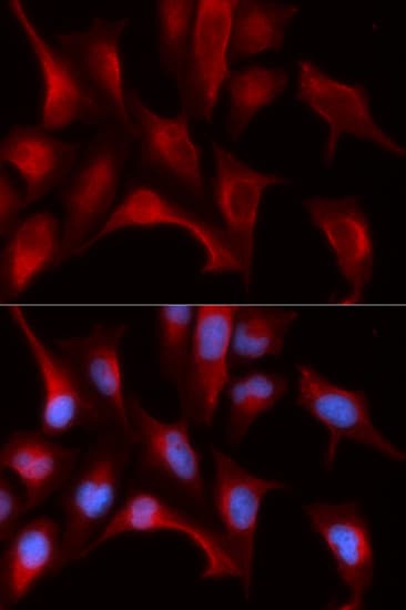 Polyclonal Rabbit anti-Human PSMB4 Antibody (IHC, IF, WB)