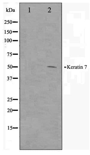 KRT7 / CK7 / Cytokeratin 7 Antibody
