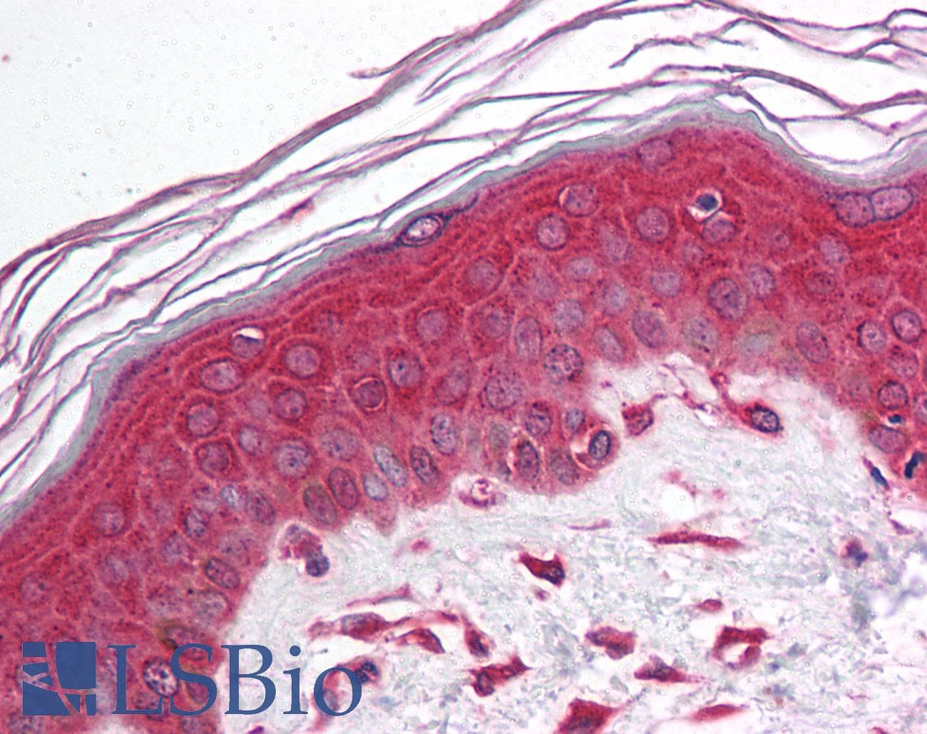 NFKBIA / IKB Alpha / IKBA Antibody (N-Terminus)