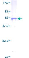 Human SCAMP1 / SCAMP Protein (Recombinant GST)