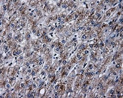PLEK / Pleckstrin Antibody (clone OTI2D11)