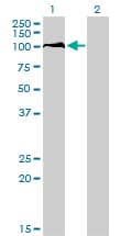 DP97 / DDX54 Antibody (clone 2H6)