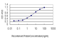 IHC-plus™ NEUROD1 Antibody (clone 3D11)