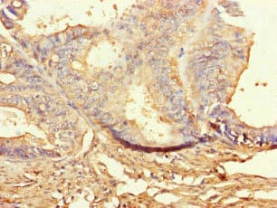 BUB1B / BubR1 Antibody (aa230-394)