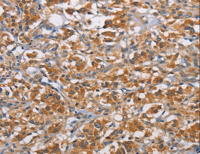 RICTOR Antibody