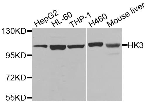 IHC-plus™ Polyclonal Rabbit anti-Human HK3 / Hexokinase 3 Antibody (IHC, WB)