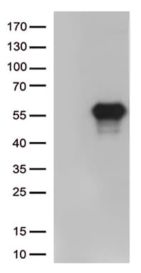 HAVCR2 / TIM-3 Antibody (clone OTI1D10)