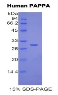 Human PAPPA / PAPP-A Protein (Recombinant His)