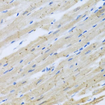 Polyclonal Rabbit anti-Human CLIP1 / CLIP-170 Antibody (IHC, WB)