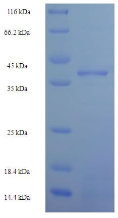 Human ZNF581 Protein (Recombinant His-SUMO)