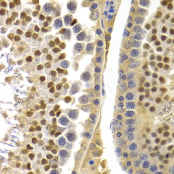 APOBEC3G / CEM15 Antibody